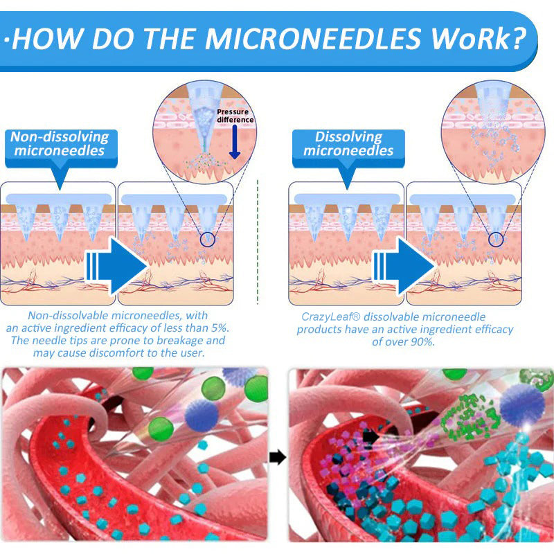 CrazyLeaf® 💙 Nano Microneedle Patch with SMGT-GLP-1, Matrixyl 3000, Botox & Collagen Peptides – Targets: Obesity, Skin Firmness, Cardiovascular Disease, Diabetes, Sleep Apnea, Joint Issues, and More 2