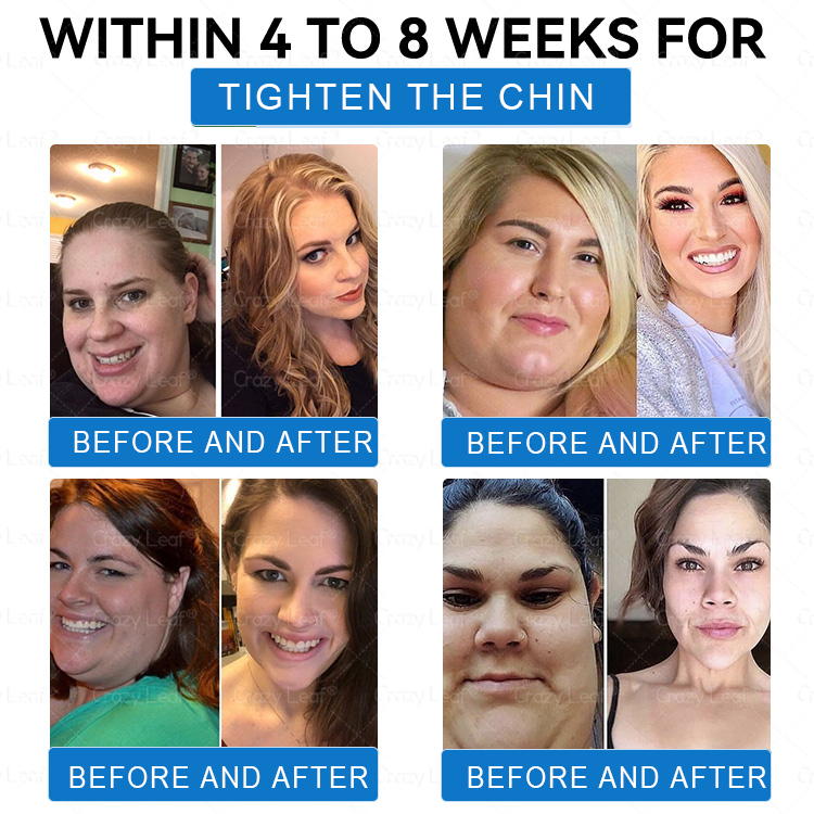 Only 5 boxes left! We're offering you an additional 40% discount! Get yourself in shape and healthy. Miss out now, and you won't have another chance until next year.CrazyLeaf®
