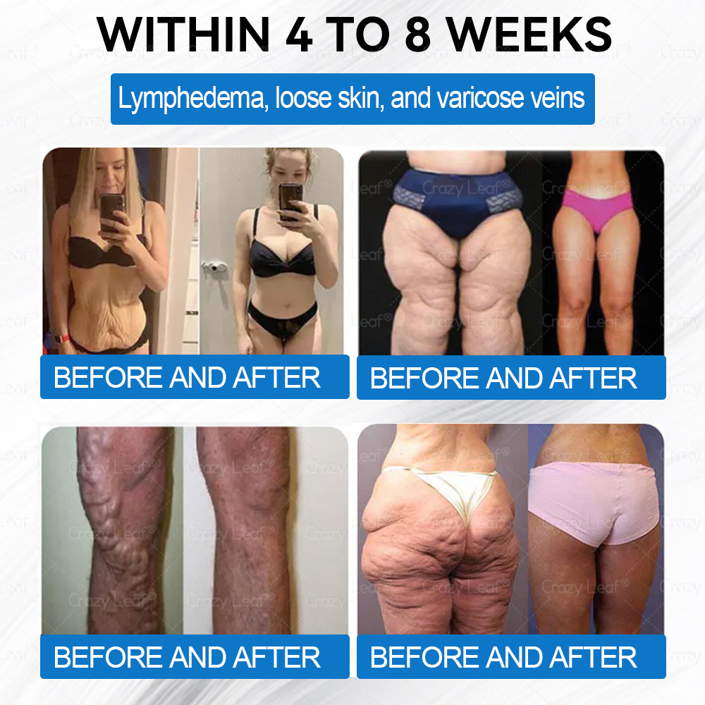 Only 5 boxes left! We're offering you an additional 40% discount! Get yourself in shape and healthy. Miss out now, and you won't have another chance until next year.CrazyLeaf®